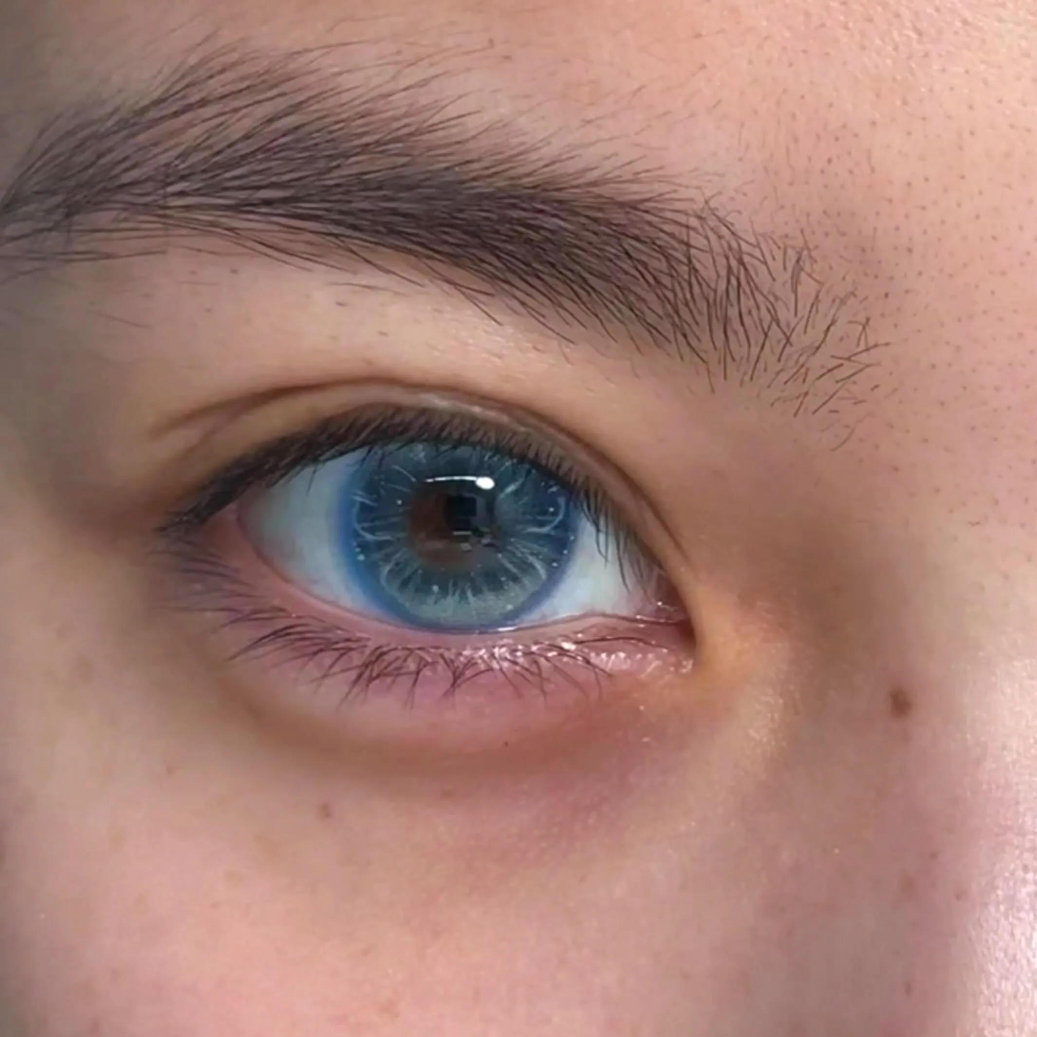 EyeLensy Jellyfish Glow Blue | 6 Months
